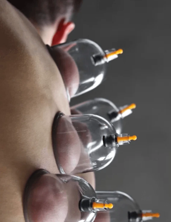 cupping therapy massage pointe-claire qc
